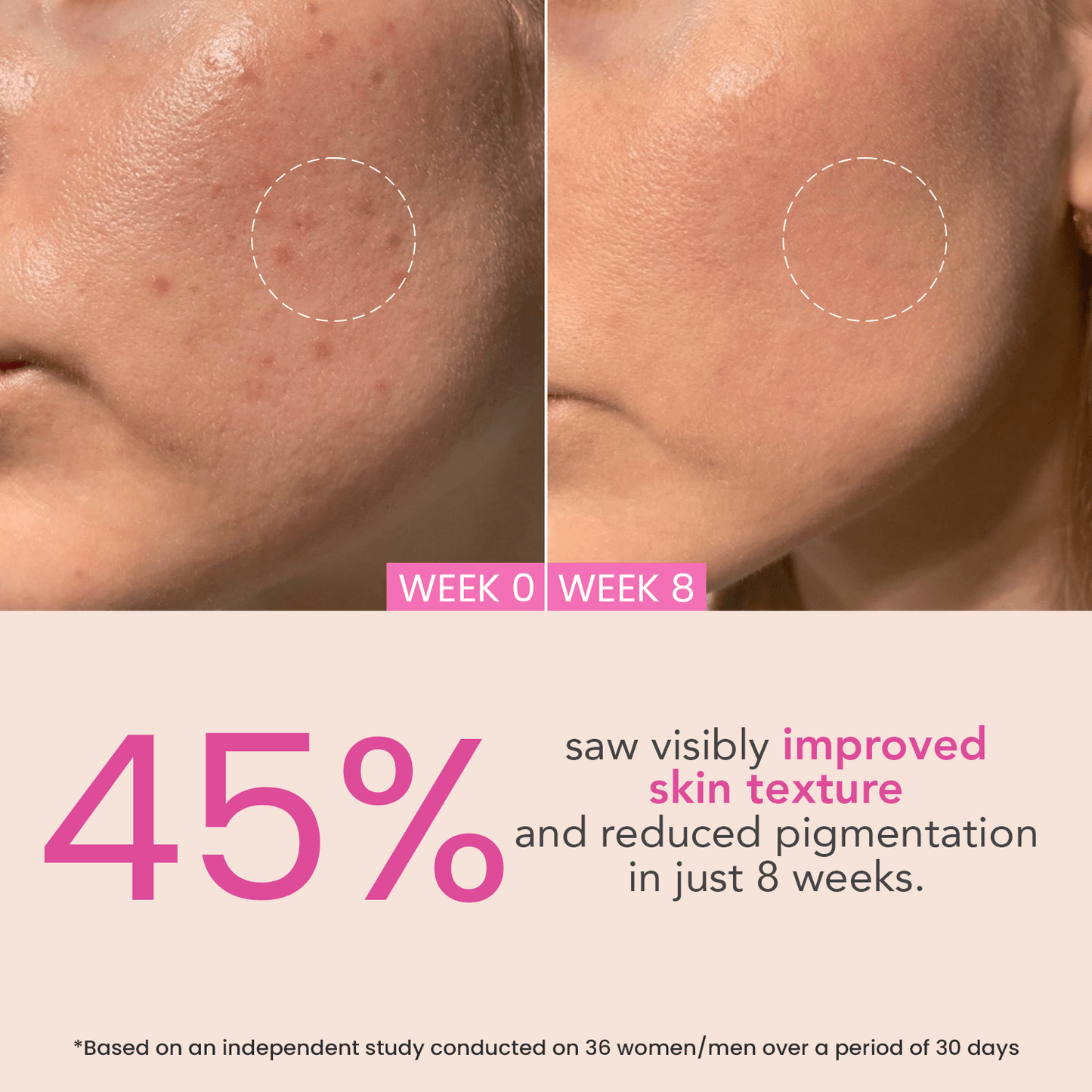 O3+ Night Repair Cream Brightening|50 gms|MRP 955