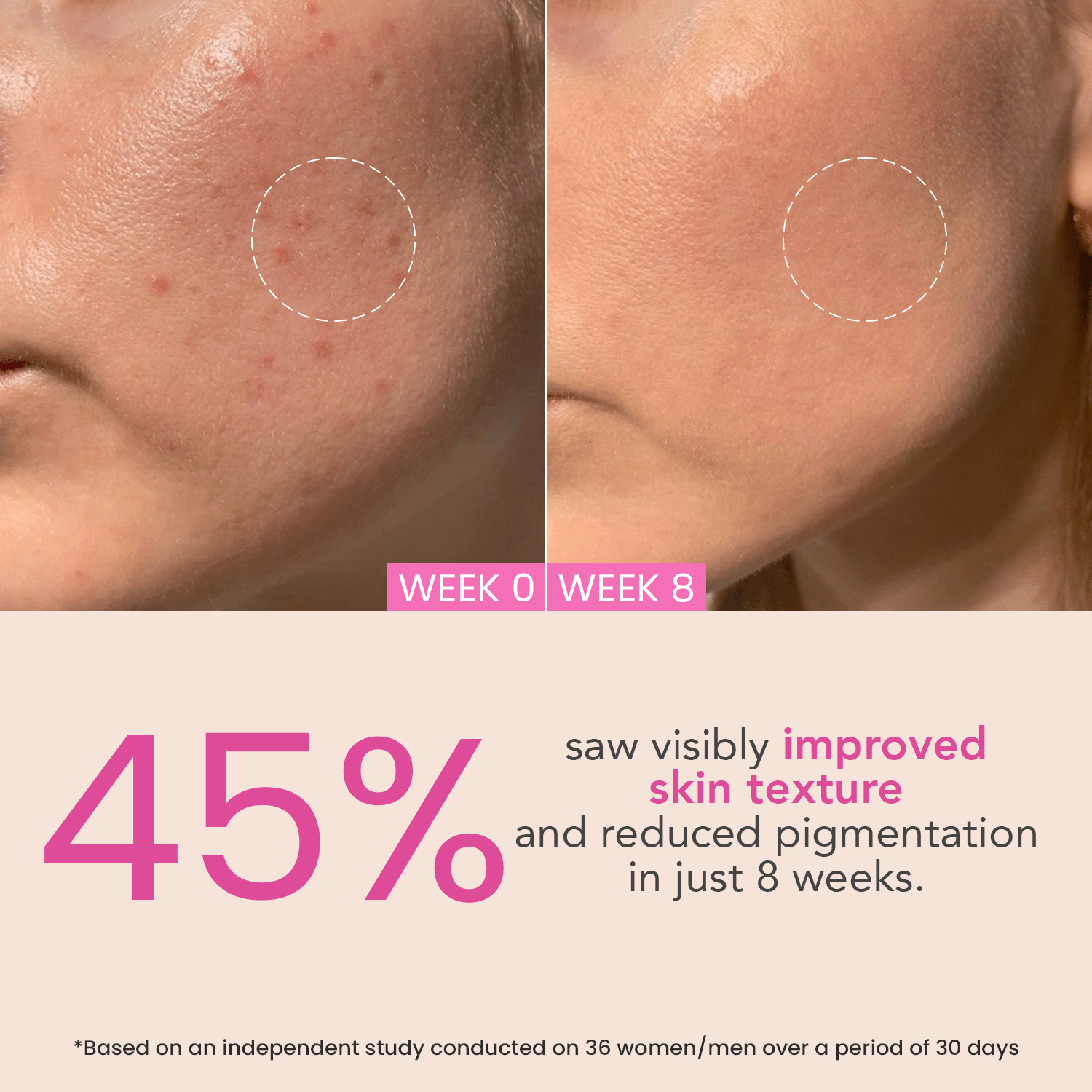 O3+ Night Repair Cream Brightening|50 gms|MRP 955