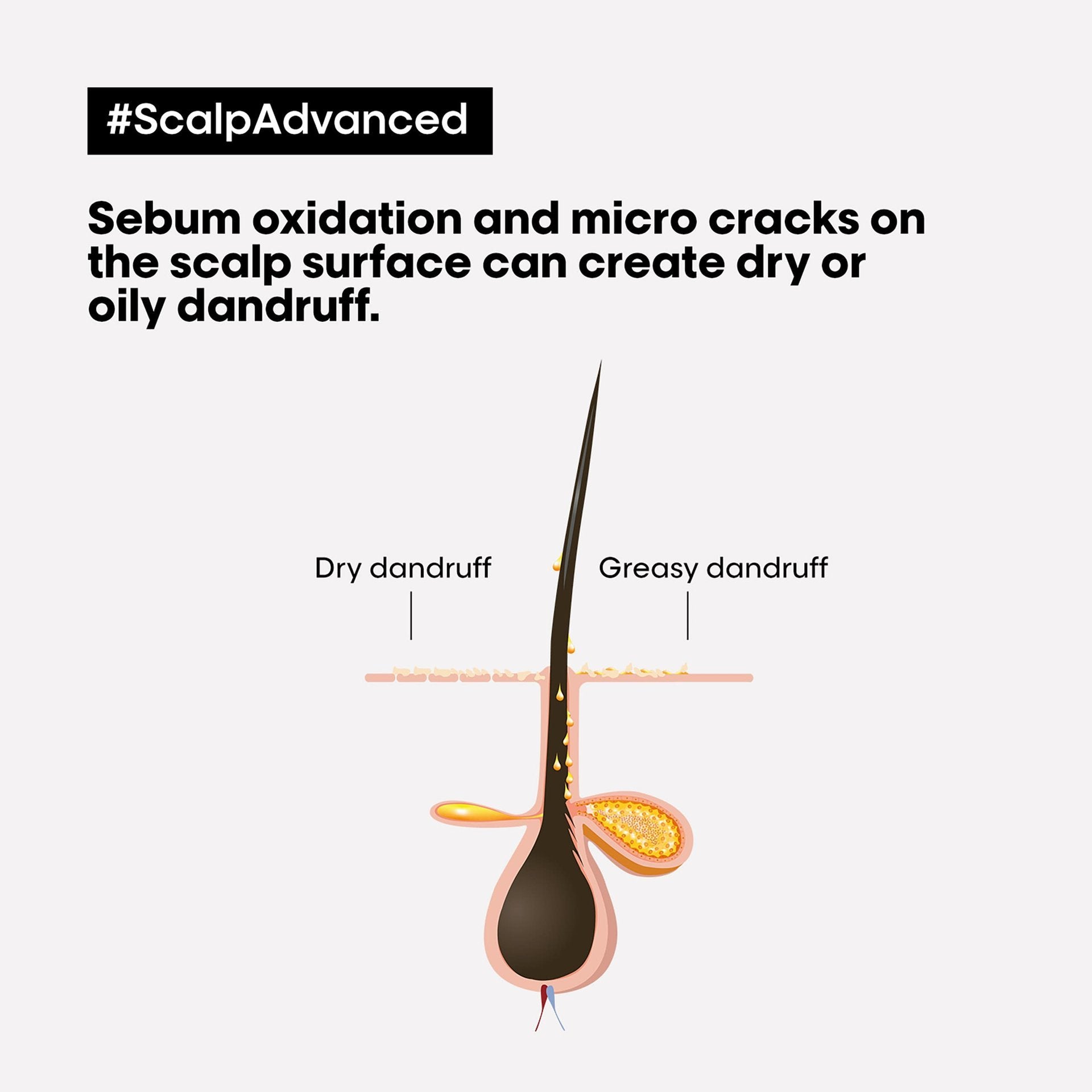 L'Oreal Professionnel Scalp Advanced shampoo|300 ml|MRP 990