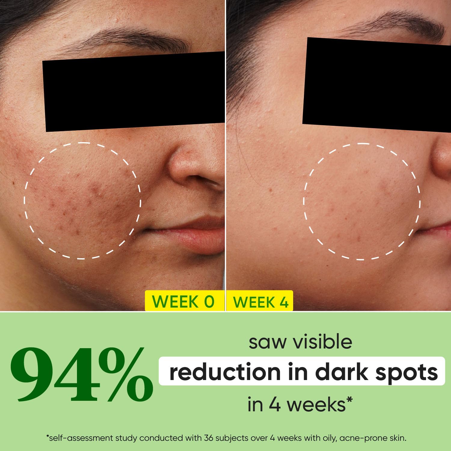 Dot & Key Cica Niacinamide Serum, oil balance skincare, skin clarity serum, blemish care