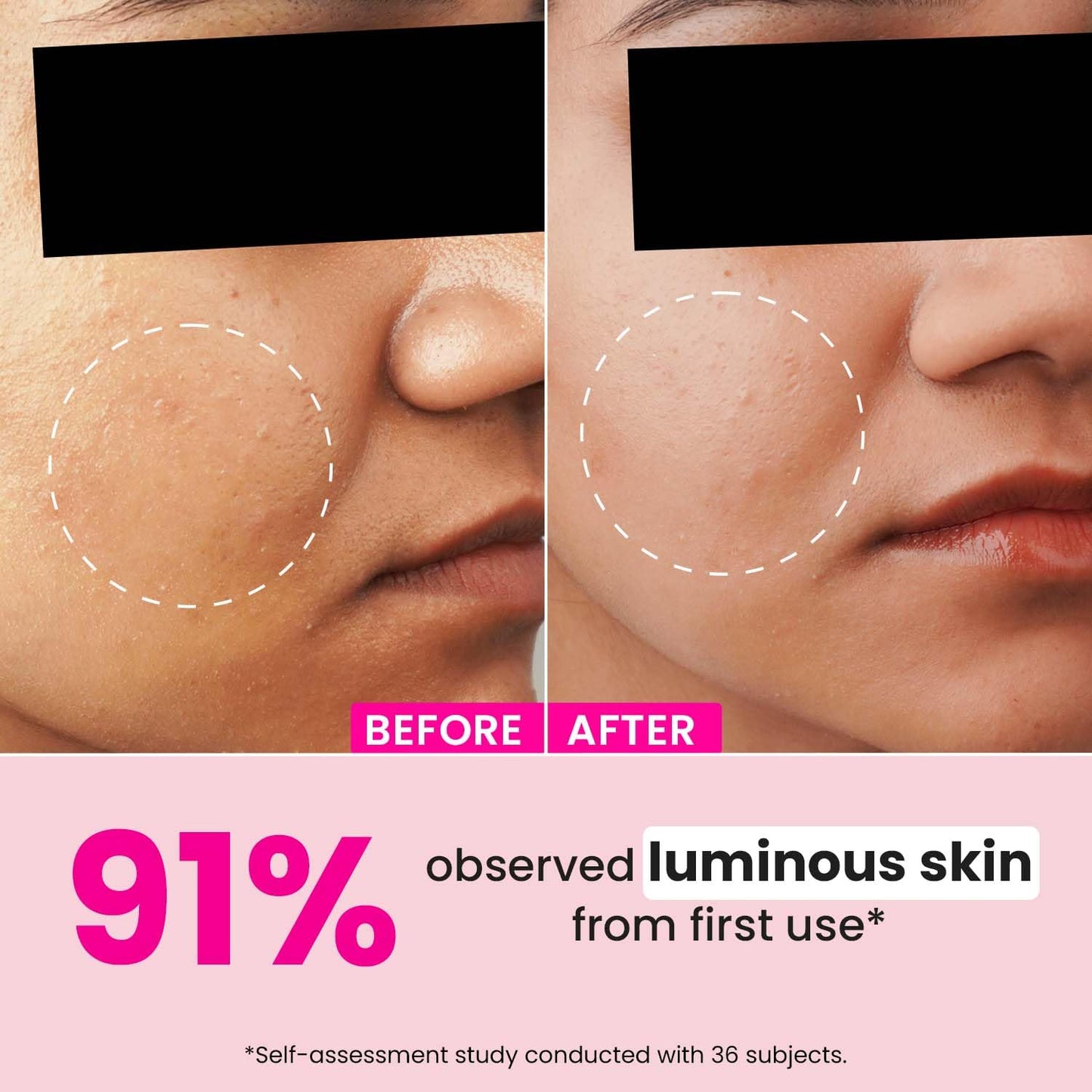 Dot & Key Watermelon Glycolic Serum, gentle exfoliation care, smooth skin texture