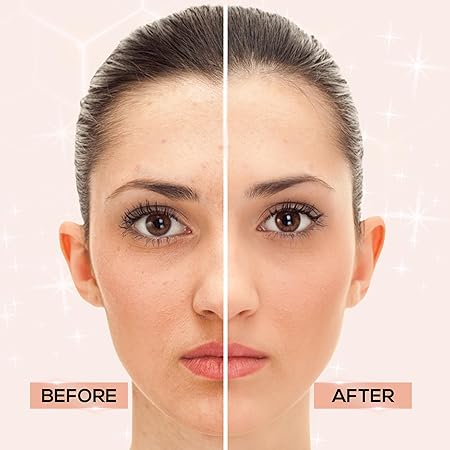 Renee Rice Water & 10% Niacinamide Face Serum|30 ml|MRP 499