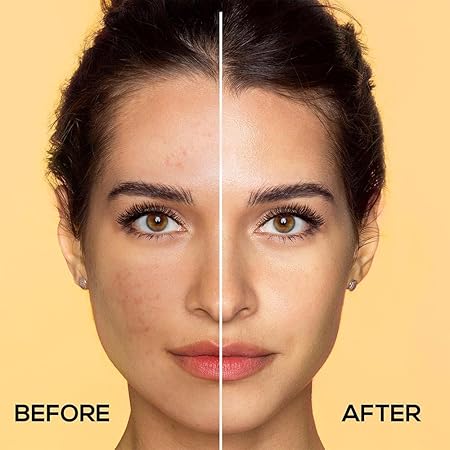 Renee Vitamin C, Salicylic & Niacinamide Serum|30 ml|MRP 550