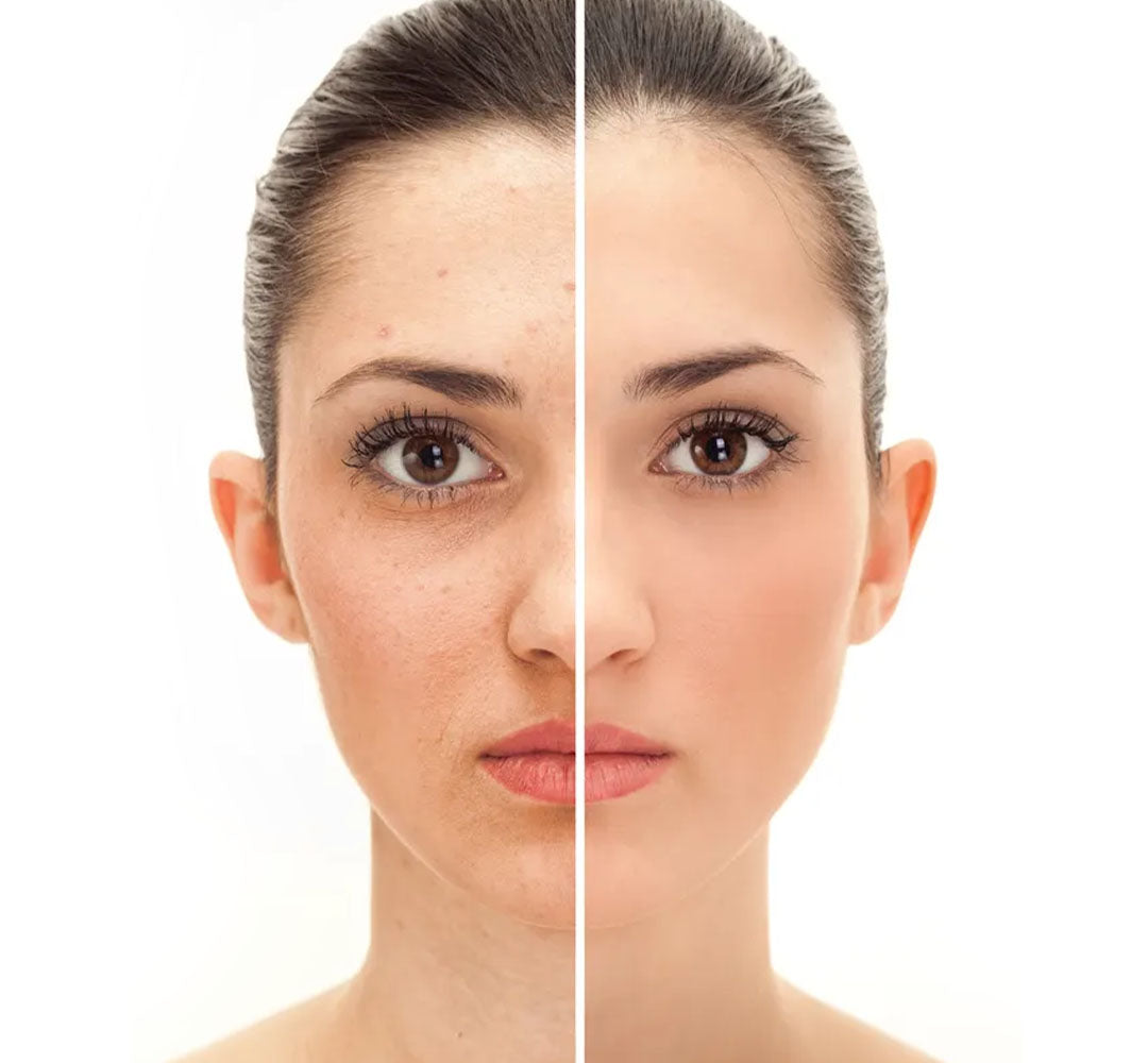 Shopaarel Flawless Fixing Powder – Long-Lasting Matte Finish | 20g