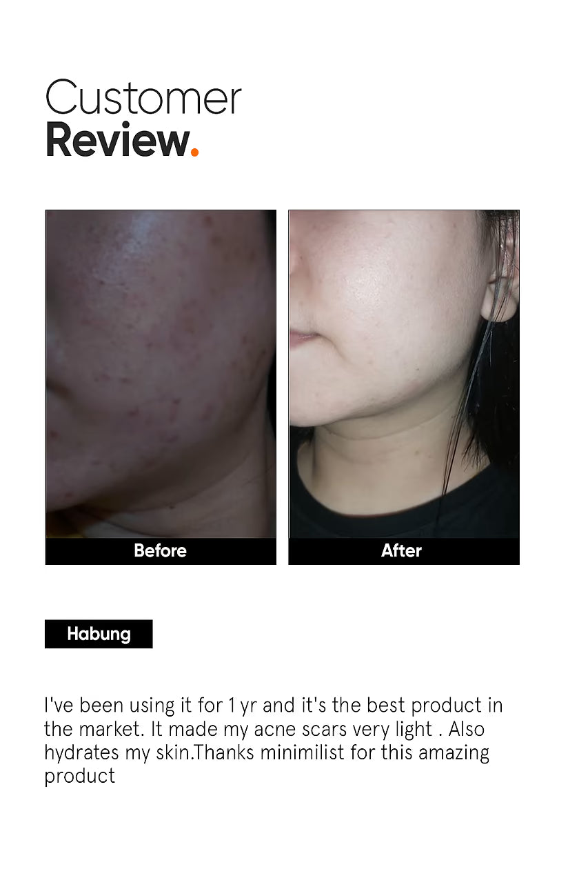 Minimalist Alpha Arbutin 2% Face Serum|30ml|MRP 549