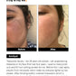 Minimalist Tranexamic 3% Face Serum|30ml|MRP 649