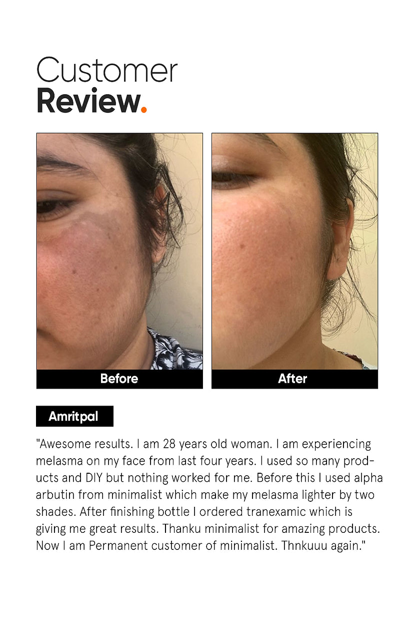 Minimalist Tranexamic 3% Face Serum|30ml|MRP 649