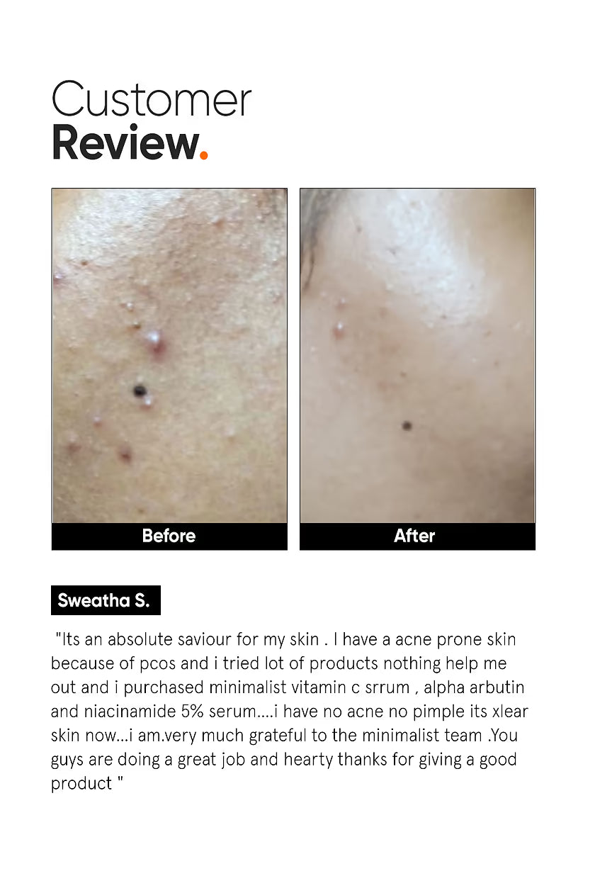 Minimalist  Vitamin C 10% Face Serum|30ml|MRP 699