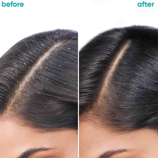 Biolage Scalppure Conditioner